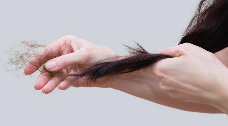 Can Cannabis Help Prevent Hair Loss?